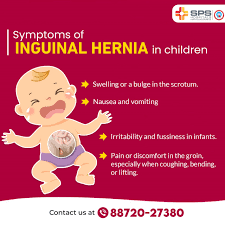 Image result for Inguinal hernia child