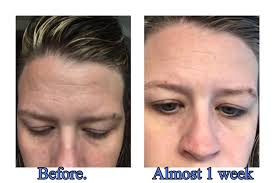 Results of using skincare product