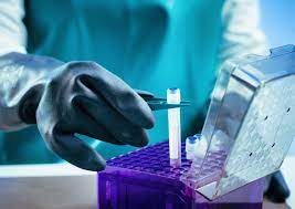 Banca delle cellule staminali del cordone ombelicale l'applicazione terapeutica delle cellule staminali del cordone ombelicale giustifica il crescente interesse nella loro crioconservazione ed è di conseguenza fondamentale, nell'ottica di una conservazione a lungo temine, scegliere la miglior banca per la conservazione delle cellule staminali del cordone ombelicale. Scomparsi Cordoni Ombelicali Banca Staminali Denunciata In Svizzera Sanita Ansa It