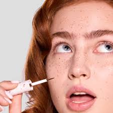 Image result for Freckles