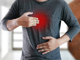 Gastroesophageal reflux disease is a chronic condition that occurs when stomach acid flows back into the esophagus, irritating its lining. Can Cannabis Treat Gastroesophageal Reflux Disease Gerd The Growthop
