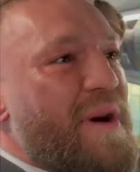 Cody Garbrandt's new look : r/ufc