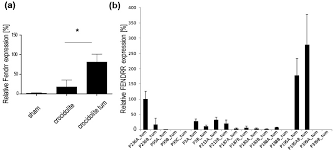 Check spelling or type a new query. Ijms Free Full Text Non Coding Transcript Heterogeneity In Mesothelioma Insights From Asbestos Exposed Mice