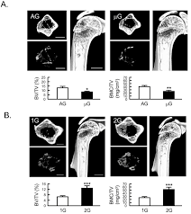 There are three types of muscle in the body. Gravity Changes Mass Of Muscles And Bones Which Was Experimentally Observed In Space