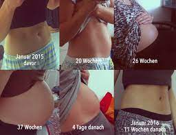 Mein Bauch Vor Und Nach Der Schwangerschaft