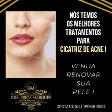 Erica Marques: Centro de Estética