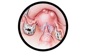 Endometriosis is a full body condition in which cells similar to those in the endometrium, the layer of tissue that normally covers the inside of the uterus, grow outside the uterus. Endometriosi Malattia Invalidante Come Richiedere Le Esenzioni Pazienti It