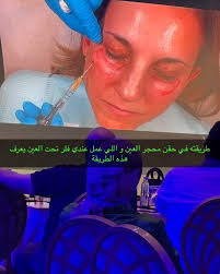 المؤتمر العلمي لفلر Maili الديناميكي الجديد🌸💖🌹, @drsamia_ismail , 🌷💖🌹