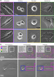 Read their latest news right here. Democratising Deep Learning For Microscopy With Zerocostdl4mic Nature Communications