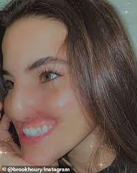 Model Brooklinn Khoury opens up about life changes after pit bull rips off  lip in horrific attack