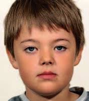 Hur skulle du behandla patienten?