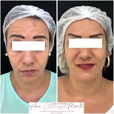 Dra Ana Clarisse Murta