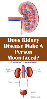 Pin On What Is Kidney Disease