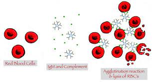 Haemolytic transfusion reaction