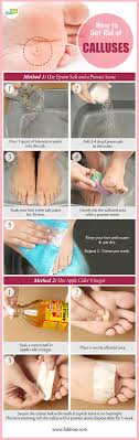You can follow up an apple cider vinegar foot soak with a baking soda solution. How To Remove Calluses On Feet Fab How