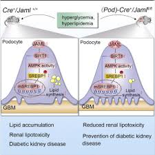 This leads to raised blood sugar levels which in the long run affects the blood vessels. Elevation Of Jaml Promotes Diabetic Kidney Disease By Modulating Podocyte Lipid Metabolism Sciencedirect