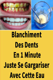 Epingle Par Marie France Sur Remedes Maison Blanchir Les Dents Naturellement Blanchir Les Dents Blanchiment Des Dents Maison
