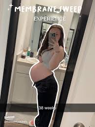 Membrane Sweep: What to Expect and How It Helps Induce Labor