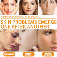 Vitamin C Serum For Face with Hyaluronic Acid, 20% Vitamin C Moisturiser  Face Women Skin Care Brighten Hydrate & Plump Skin, Anti Aging Brightening  Wrinkle Facial Serum (Vitamin C) : Buy Online