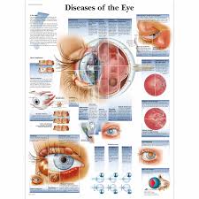 Ziekten Van Het Oog Grafiek 4006666 Vr1231uu Oftalmologie 3b Wetenschappelijke Diseases Of The Eye Medical Posters Disease