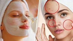 Untuk menghilangkan bintik hitam menggunakan kunyit, pertama buatlah pasta, campuran antara kunyit, air jeruk lemon, dan susu. 9 Cara Alami Hilangkan Flek Hitam Di Wajah Tanpa Perlu Skincare Mahal Tribunnews Com Mobile