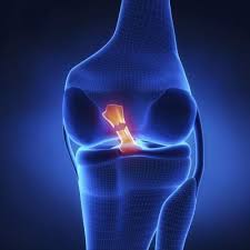 Can I Do More Damage Walking On A Torn Acl Knee Ligaments Torn Ligament In Knee Acl Tear