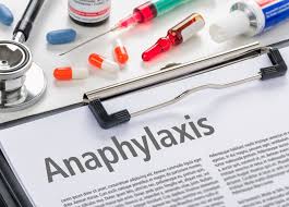 Image result for Exercise-Induced Anaphylaxis