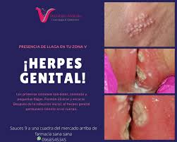 Si una madre con herpes genitales sufre llagas en el cuerpo a lo largo del parto, posiblemente transmita la infección al bebé. Dra Tatiana Alvarado Veliz Ginecologia Y Obstetricia En Guayaquil Los Primeros Sintomas Son Dolor Comezon Y Pequenas Llagas Forman Ulceras Y Escaras Despues De La Infeccion Inicial El Herpes Genital Permanece