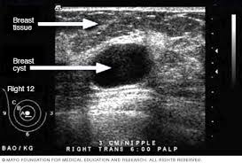 Ultrasounds use sound waves to create images of the inside of your body. Ultrasound Mayo Clinic