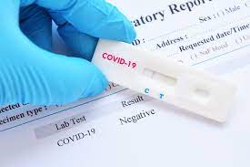 Почему нельзя чистить зубы перед сдачей теста пцр? Test Na Covid 19 Medicinskij Centr V G Sevastopole