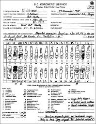 dental charting examples sada margarethaydon com