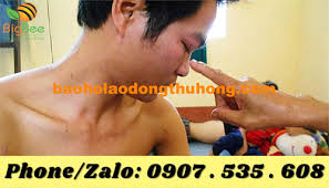 ẢNH HƯỞNG CỦA KHÓI HÀN ĐẾN SỨC KHỎE THỢ HÀN