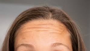 Untuk mengatasi kerontokan rambut anda dapat menggunakan buah delima. Tolak Keriput Ini 7 Manfaat Buah Delima Untuk Kulit