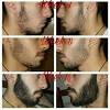 Surgery, drugs, natural products, and laser therapy. 3