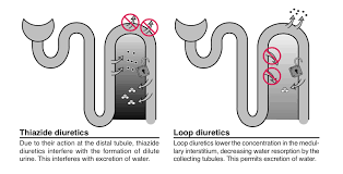 Image result for Loop Diuretic