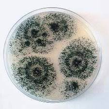 While most probiotic supplements consist of helpful bacteria, some species of the aspergillus fungi family are considered probiotic, as well, because they can impart beneficial effects. Aspergillus Niger Is One Of The Common Species Of Aspergillus A Genus Download Scientific Diagram