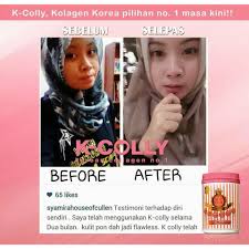 K colly sweet 17 ni tiada pantang larang,laki/perempuan boleh consume. Hot Sale K Colly Sweet 17 Collagen Original Shopee Singapore