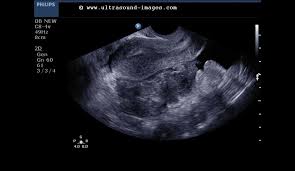 Berminat buat psv e hailing nak tahu lesen memandu murah teguh pandu facebook Fertility Infertility Drsharifahblog