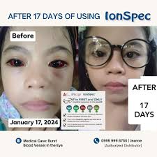 Hey everyone, This past week I had appointments with both my MS neurologist  and my ophthalmologist, and I got some news worth celebrating. My cognitive  testing came back above normal, and after