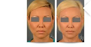 Page Not Found 404 Facial Plastic Surgery Facial Plastic Plastic Surgery