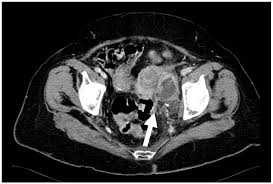 Check spelling or type a new query. Differential Diagnosis For Female Pelvic Masses Intechopen