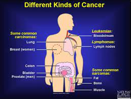 Some cancer research is based on adults only. Cisn What Is Cancer