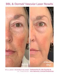 Village Dermatology added a new...