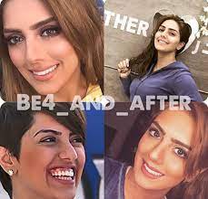 منذ ذلك الحين وحتّى اليوم، استطاعت هذه النجمة أن تلفت الأنظار بنجاحاتها الواسعة وجمالها الطبيعي. Facebook