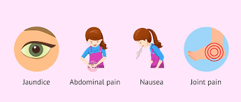 Image result for hepatitis symptoms