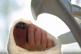 __ in case of an emergency. Broken Toe Symptoms Pictures And Treatment