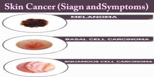 These precancerous skin growths typically appear. Skin Cancer Symptoms Diagnosis Treatment Assignment Point