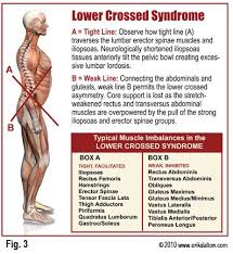 Learn the lower back muscle anatomy associated with low back pain and hip pain. Pin On Physio Stuff