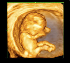 If you're an expecting mother, here's what to know about this doctor visit. Sonogram Secrets By Trimester Advanced Ultrasound Services