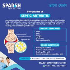 Image result for Septic Joint